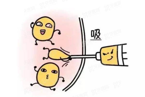 冷冻减脂瘦肩膀yimei.yadoo.cn.jpeg