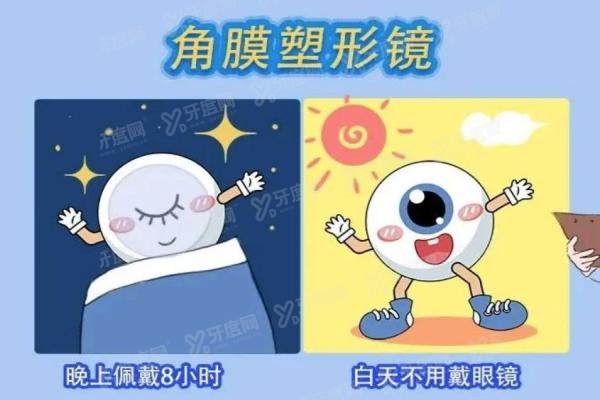 梦戴维角膜塑形镜碎了免费换吗jpg