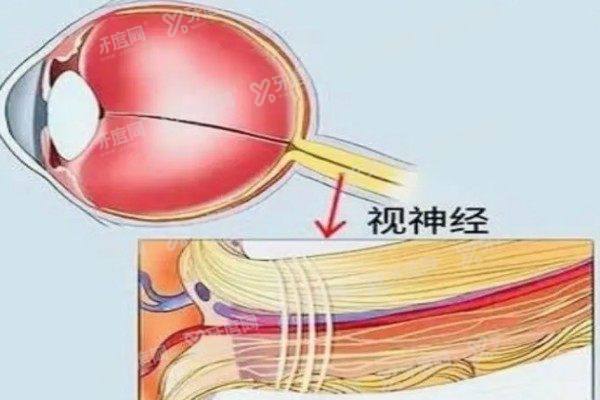 视神经再生技术有可能实现吗2.jpg