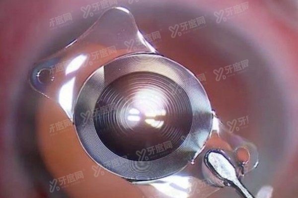 德国进口人工晶体价格表2.jpg