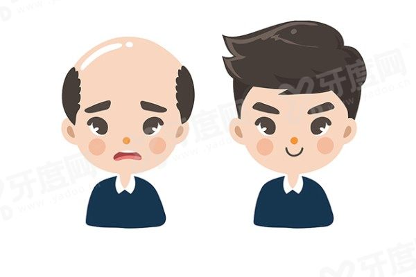 不剃发植发和剃发植发区别