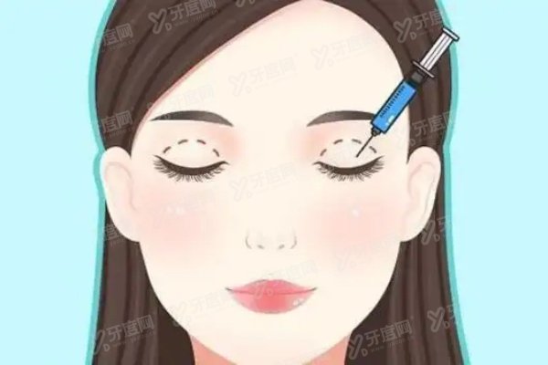 于晓波医生做双眼皮怎么样