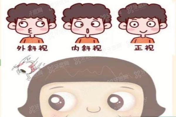 王乐今做斜视手术怎么样.jpg