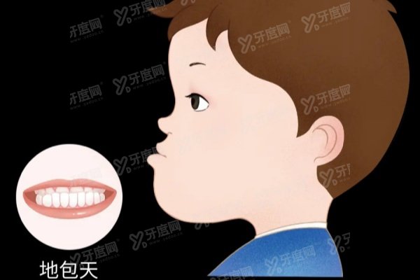 重庆松山医院正颌手术怎么样