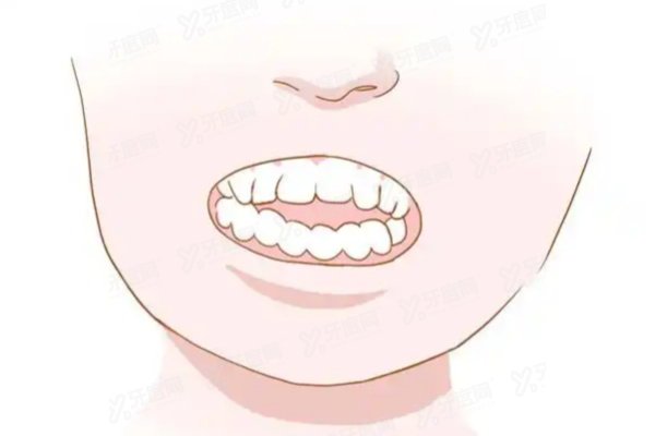 重庆松山医院正颌手术肖林医