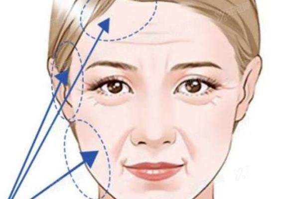 做了拉皮手术很后悔：疤痕、僵硬、成效差？后悔原因大揭秘！