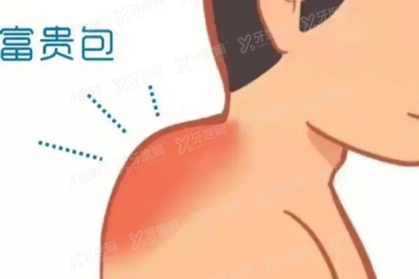 曹孟君富贵包有<span style=