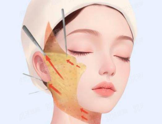 北京加减美整形医院医生