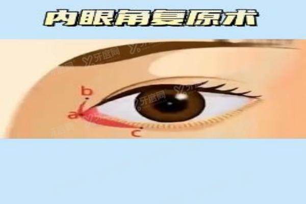 北京眼修复医生排名前十名