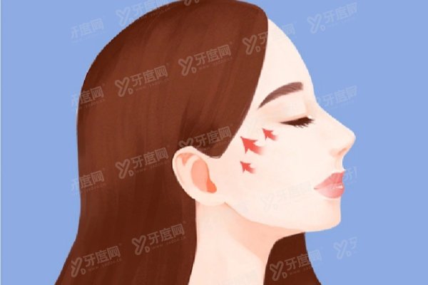 王明利脂肪填充<span style=