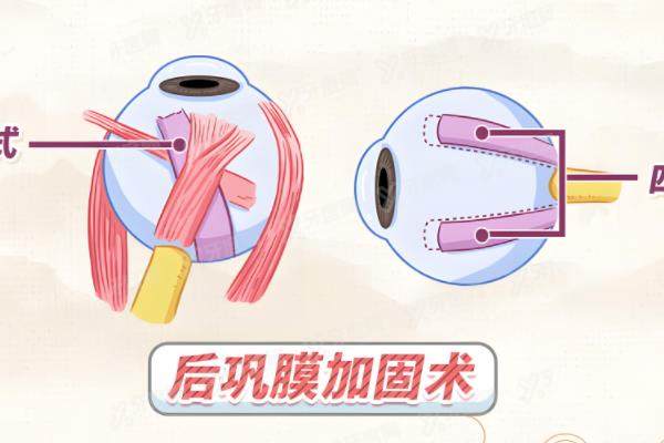 王乐今在国内眼科什么水平?属于高端水平不仅眼球震颤新技术靠谱/后巩膜口碑也不错.jpg