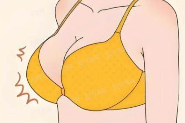 贺天遥医生丰胸怎么样