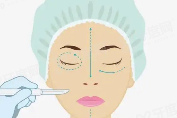 郑州做双眼皮有<span style=