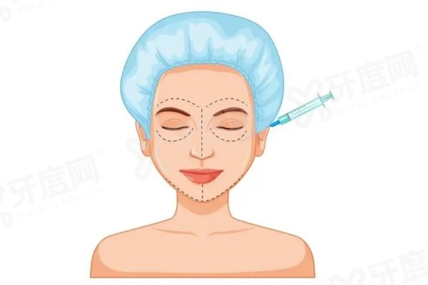 郑州做双眼皮医生哪个好