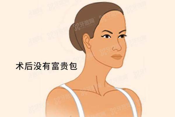 黄学峰一针去除富贵真的假的