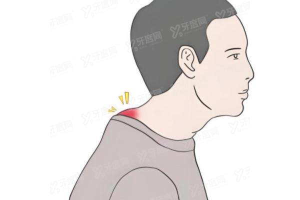 黄学峰一针去除富贵包术后怎么保养