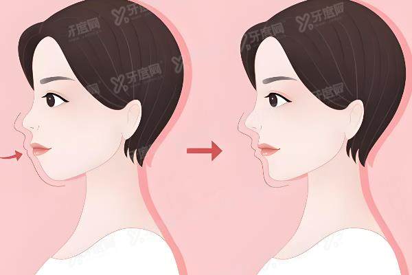 国内正颌手术好的医生