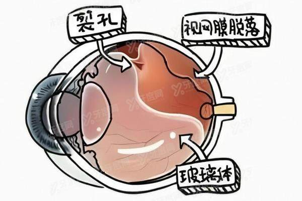 吉林恒达眼科医院医生介绍:彭秀芹/王仙芝邓医生视神经萎缩技术好.jpg