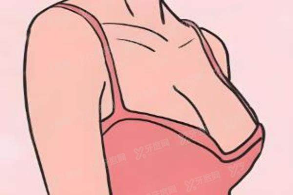 高超医生做隆胸口碑如何