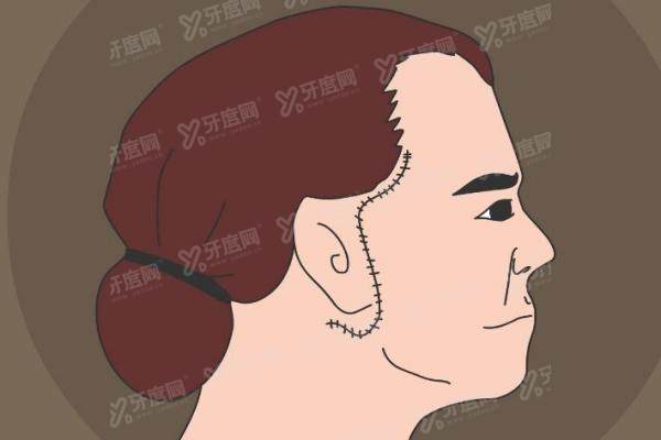 深圳拉皮做得好的医院排名前五名