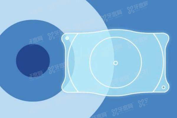 多焦点人工晶体报销比例