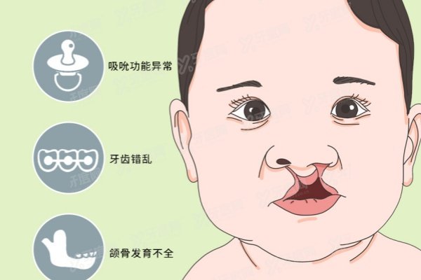 上海唇裂修复医院排名前三名
