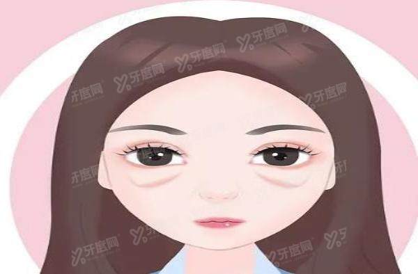 北京雅靓医院祛眼袋多少钱