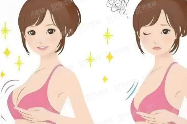 王丽君医生做隆胸怎么样