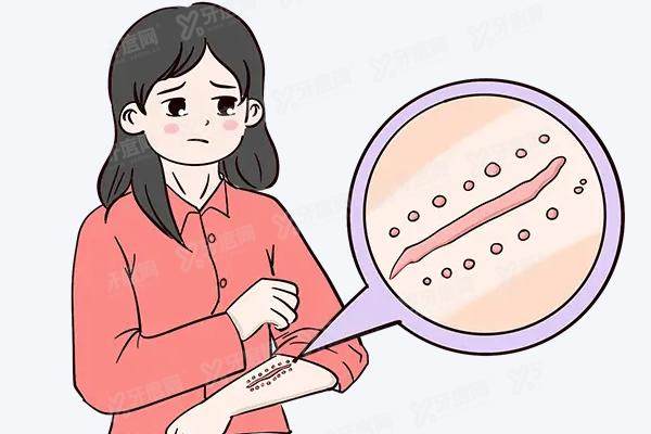 合肥疤痕修复医院排名前五名
