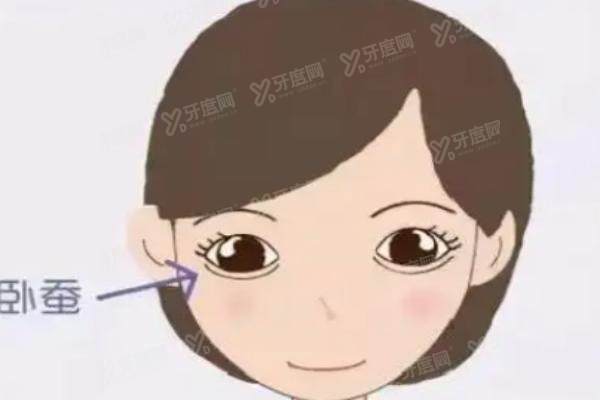 郑小红医生做双眼皮口碑评价怎么样