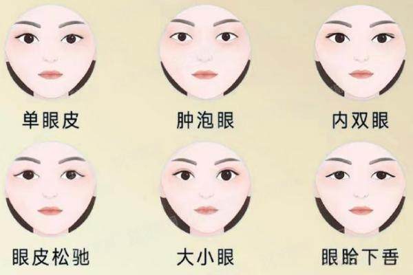吕方中医生做双眼皮怎么样
