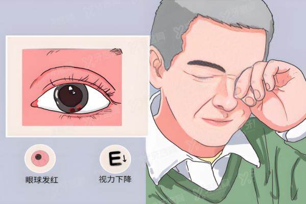 眼睛后巩膜加固术多大年龄做合适呢？.jpg