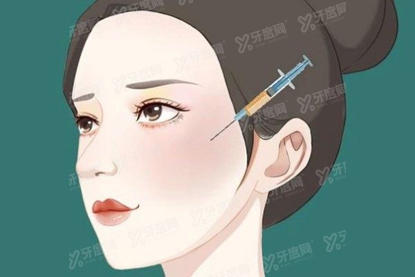 南京脂肪填充医院排名前十