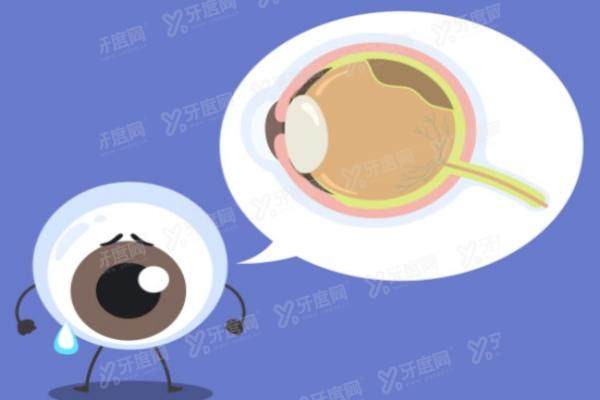 人工虹膜怎么不引进国内.jpg