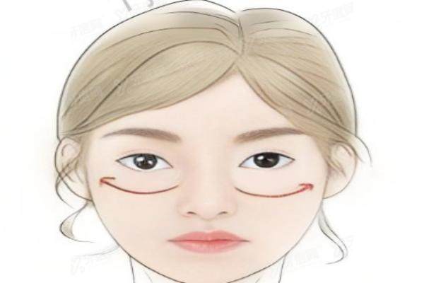 李春财医生做脂肪填充好吗