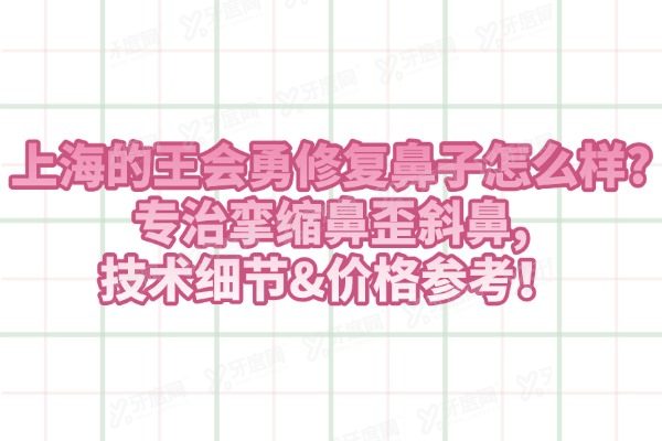 上海的王会勇修复鼻子怎么样