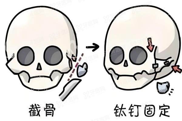 张笑天和黄大勇哪个贵