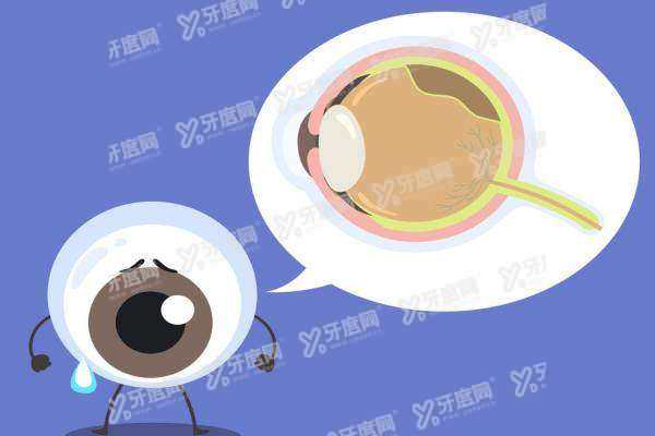 人工虹膜植入手术能报销吗
