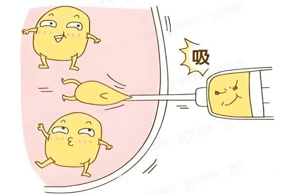 袁玉坤医生做脂肪填充怎么样