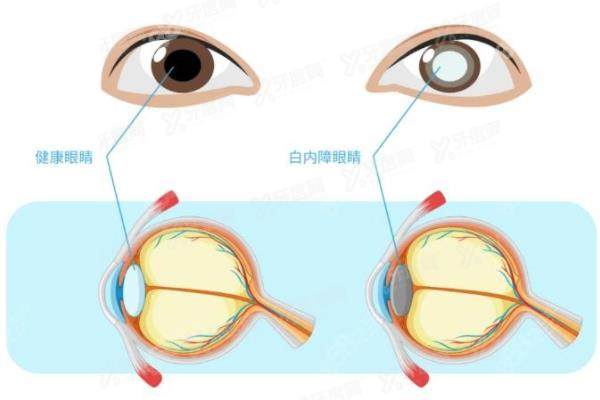 中南大学湘雅医院眼科路线.jpg