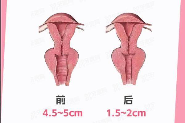 杭州紧缩针哪家医院有