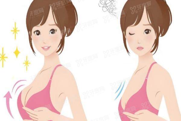 徐恩旭隆胸是正规的吗