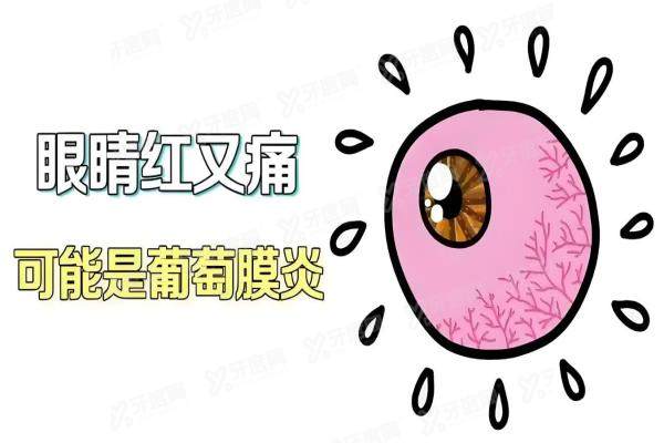 杨培增看葡萄膜炎真的很 好吗？专注葡萄膜炎30余年，出诊时间+挂号技巧汇总