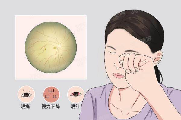 杨培增看葡萄膜炎真的很 好吗？专注葡萄膜炎30余年，出诊时间+挂号技巧汇总3