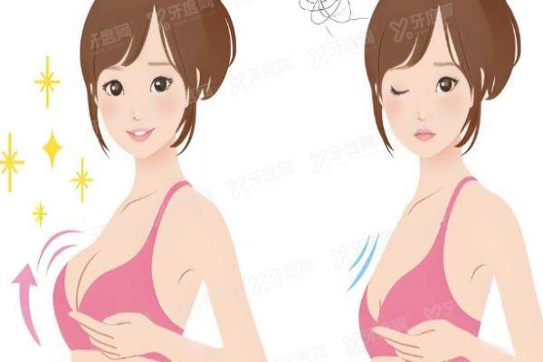 成都出彩丰胸有失败实例吗