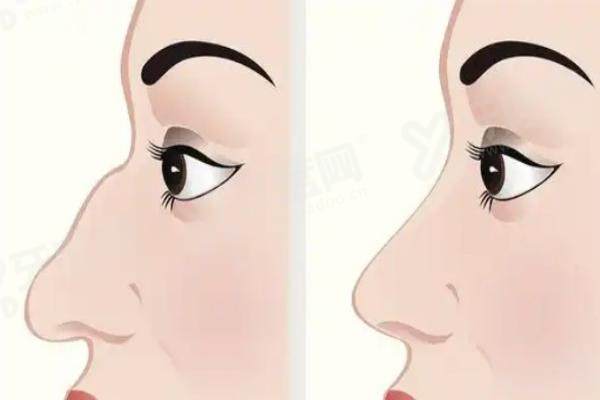 北京王旭东医生坐诊医院 北京王旭东医生坐诊医院