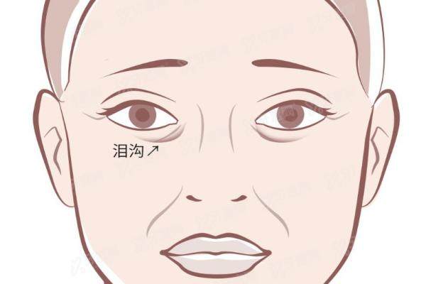 北京艺星整形医院做泪沟手术好吗