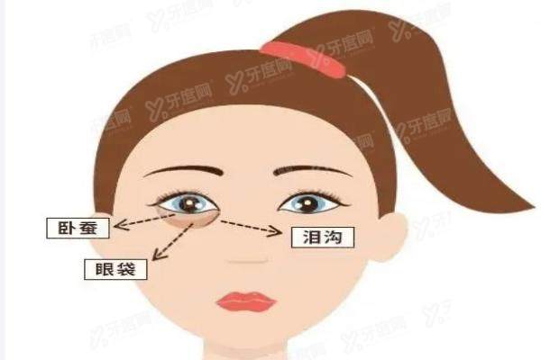 北京艺星整形医院做泪沟手术多少钱