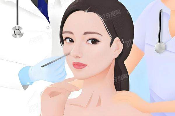 鲁礼新做的鼻子好吗？技术派隆鼻/鼻修复大拿，自然不假，价格案 例全公开！
