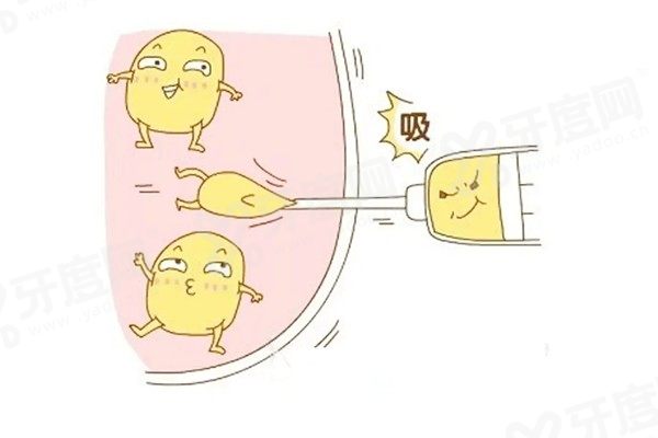 全身吸脂价格一览表：含吸脂10斤|20斤|30斤|50斤费用及术后真实感受